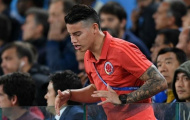 Colombia thất bại, James Rodriguez sụp đổ