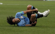 Edinson Cavani cần 'phá hủy y học' nếu muốn tử chiến với Pháp