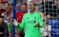Loris Karius 'ói bóng', Liverpool nhận 2 bàn thua trước đội bóng League Two
