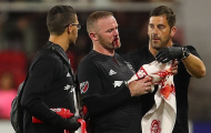 Rooney ghi bàn đẳng cấp rồi đổ máu trong chiến thắng của DC United