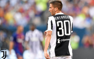 Lộ diện đội hình dự bị cực chất của Juventus