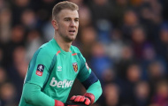 Vừa bán xong Joe Hart, Manchester City lập tức gọi anh là 'huyền thoại vĩnh cửu'