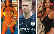 De Bruyne chấn thương, fan cuồng ngực khủng an ủi tận tình