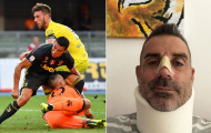 Đối thủ 'ngã mũ khâm phục' trước hành động đẹp của Ronaldo