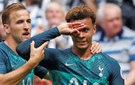 Dele Alli thách thức thế giới với động tác ăn mừng từ 'phim con heo'
