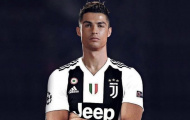 Sau khi tập luyện với mắt tím bầm, Ronaldo ra yêu cầu cực gắt với Juventus