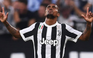 Douglas Costa phải ngồi ngoài một tháng vì chấn thương kép