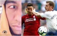 Nguy cho Liverpool, chấn thương của Firmino vẫn chưa thuyên giảm