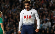 HLV Pochettino cập nhật tình hình chấn thương của Alli