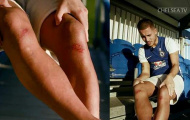 Chỉ đôi chân đỏ tấy, Hazard hứa bỏ thói quen ăn mừng