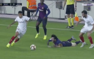 Sốc! Messi nguy cơ nghỉ El Classico sau chấn thương rùng rợn