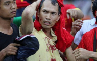 AFF Cup và top 6 'trò bẩn' khiến Đông Nam Á muối mặt