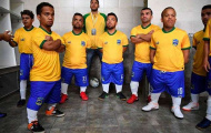 Dwarf Copa America 2018 - Giải đấu của những ngôi sao tí hon