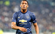 Deschamps: Martial cần phải làm điều này