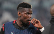 Ơn trời! Pogba đã đối mặt với nỗi sợ hãi ở tuổi 25