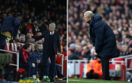 Wenger tiết lộ lý do hay gặp khó khăn khi kéo khóa áo khoác