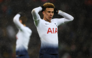 'Alli đã thoát khỏi Koscielny quá dễ dàng'