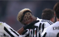 Sốc! Pogba xuất hiện trên trang chủ Juventus, đếm ngày rời M.U?