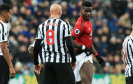 'Cậu ta gặp may khi đạp vào đùi Pogba'