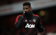HLV Allegri nói thẳng về việc mua lại Paul Pogba