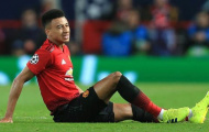 'Lingard là lí do để Chelsea đánh bại Man Utd'