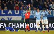 'Tội đồ' của Man City thể hiện ra sao trước Schalke ?