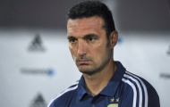 Lionel Scaloni đối mặt với vấn đề muôn thuở tại Argentina