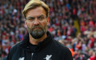 Klopp: 'Vì chuyên gia từ M.U, chỉ có HLV Liverpool mới bị hỏi như thế'