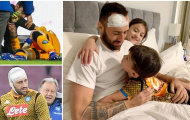 Ospina hồi phục thần kì sau chấn thương đầu khủng khiếp