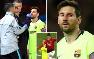 SỐC: Vẻ ngoài 'không thể tin được' của Messi sau cú tát của Smalling