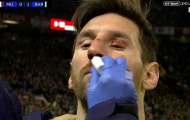 Smalling khiến Messi đổ máu ở Old Trafford