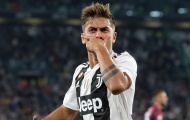 Thua đơn thiệt kép: Juventus mất Dybala hai tuần vì chấn thương