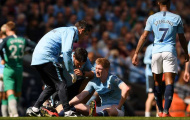 'De Bruyne chấn thương là điều dĩ nhiên'