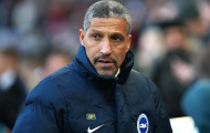 CHÍNH THỨC: Brighton gây sốc sau khi thua Man City