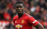 Pogba và nỗi khổ tâm của cái giá 89 triệu bảng