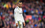 Chi 273 triệu bảng, Real Madrid vẫn đau đầu vì... 45 triệu bảng!
