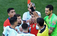 Khiến Messi nhận thẻ đỏ, thủ quân Chile nói gì?