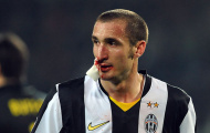 Giorgio Chiellini: Khi máu và mồ hôi tạo nên người đội trưởng vĩ đại