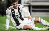 Ngôi sao số 1 của Juventus chấn thương trước thềm trận giao hữu nội bộ