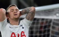 Khôn ngoan cách mấy, Tottenham vẫn lỗ 40 triệu bảng ở thương vụ này