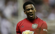 Thiếu sót chí mạng trong khâu chuyển nhượng, Man Utd đang phải trả giá cực đắt