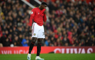 Với Axel Tuanzebe, Man Utd có một đáp án cho ba lời giải
