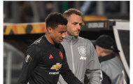 'Lingard dính chấn thương là tin tức rất tốt lành'