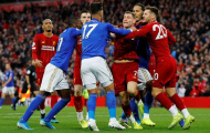 SỐC! Klopp nói thẳng cái tên Liverpool gây hấn dẫn đến vụ ẩu đả