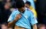 Bại trận, fan Man City tức điên: 'Quá tệ hại, cậu ta cần biến đí'