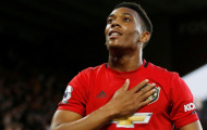Fan Man Utd mỉa mai Martial: 'Cùng lắm là 11 bàn, Welbeck nước Pháp'