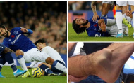 SỐC! Son Heung-min đạp gãy chân cựu sao Barca, khóc ngất rời sân