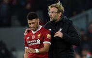 Oxlade-Chamberlain: Cờ đã đến tay, sao lại không phất?