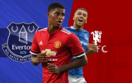 Solskjaer cần đưa ra 3 lựa chọn khi đối đầu Everton