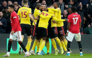 Từ Welbeck tới Lingard, kỹ thuật có hạn thì chớ mạo hiểm lốp bóng
